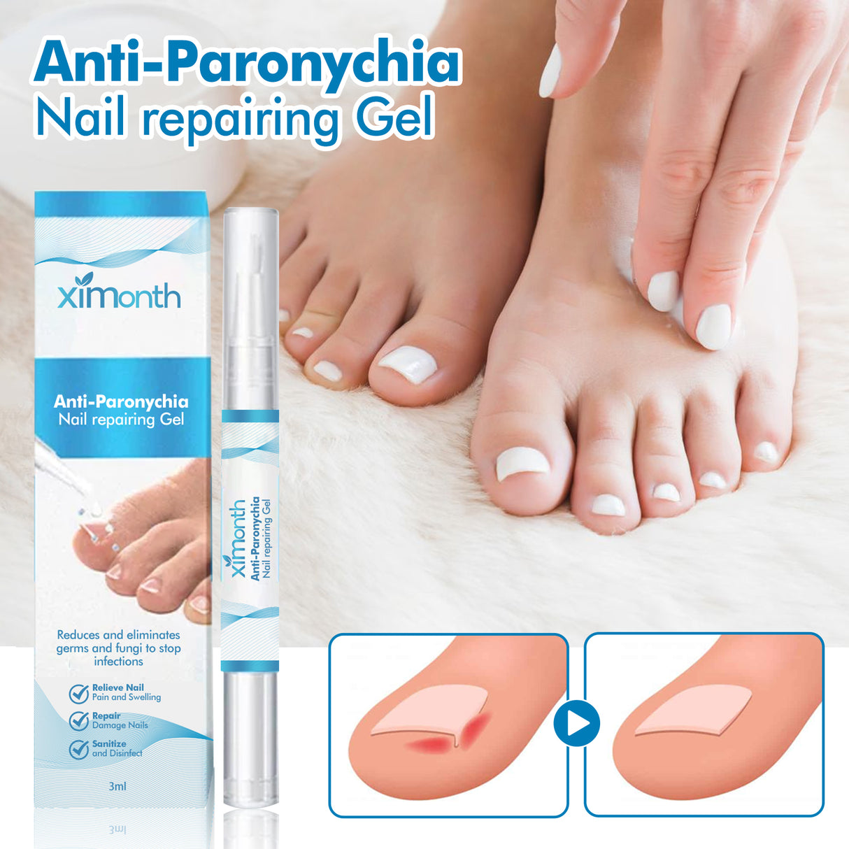 Anti-Paronychia Nail Repairing Gel, Repair Encased Rotten Nails Soft Nails Thickening Pain Relief Cleansing Care - V.I.P Digital Presence