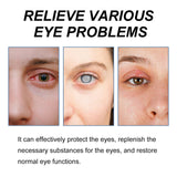 Myopic Eye Drops For Eye Fatigue, Swelling, Swelling, Blurred Vision Mild Eye Drops - V.I.P Digital Presence