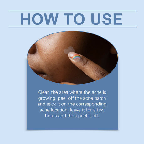 Cloud Acne Patch Repair Mild Facial Skin Clean Acne Skin Delicate Skin Care Patch - V.I.P Digital Presence