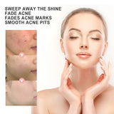 Acne Patch, Repair Acne Pimple Facial Redness Clean Pores Moisturize Skin Patch - V.I.P Digital Presence