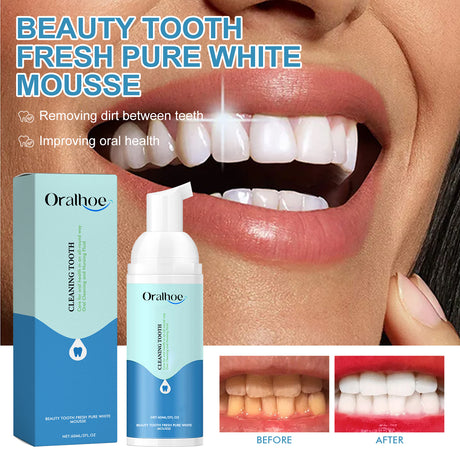Beauty Tooth Fresh Pure White Mousse, Clean Bad Breath Stains White Teeth Care Gums Care Toothpaste - V.I.P Digital Presence