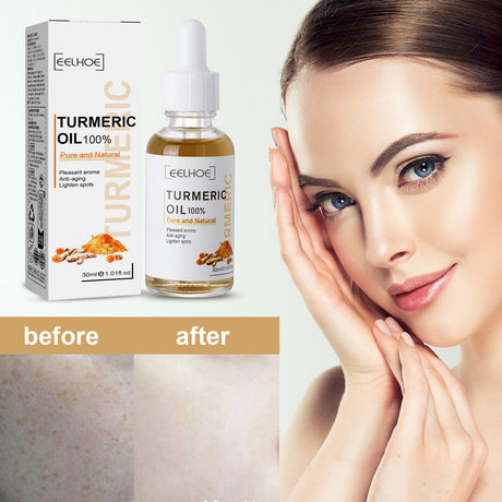 Turmeric Correction Essence Facial Care Hydrating Moisturizing Gentle Moisturizing Skin Care Essence - V.I.P Digital Presence