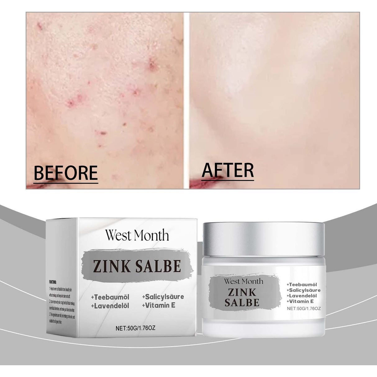 Acne Cream, Refreshing Oil Control Repair Acne Mild Soothing Closing Face Cream