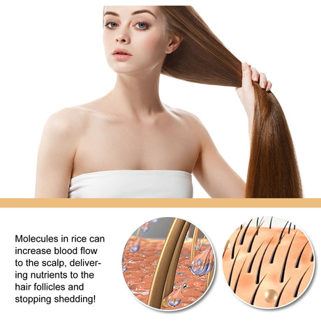 Rice Anti-Slip Shampoo Soap, Moisturizes Scalp Cleans Hair Repairs Damaged Hair And Strengthens Hair Shampoo Soap - V.I.P Digital Presence