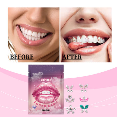 Crystal Dental Drill To Brighten Your Smile For A Long Time With Easy Use Of The Suitable Tooth Type Adhesive - V.I.P Digital Presence