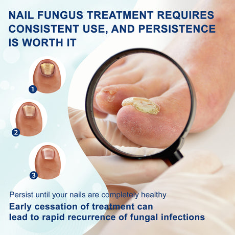 Nail Repair Pen, Repair Hands And Feet Gray Nails Brightening Nails Soft Nails Thickening Nails Moisturizing Care - V.I.P Digital Presence