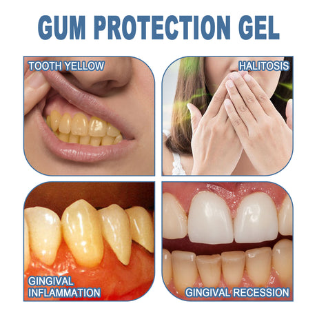 Gum Protection Gel, Teeth Whitening And Whitening Gum Repair Oral Cleaning And Care Dental Pencil - V.I.P Digital Presence