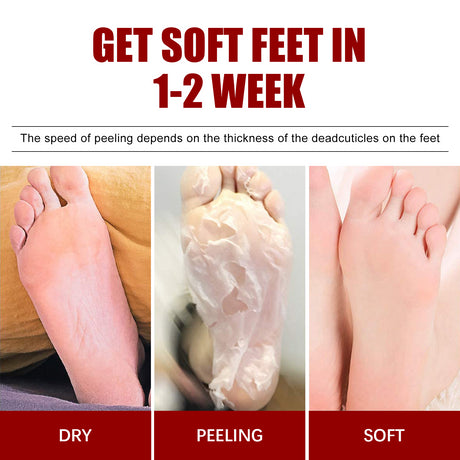 Exfolating Foot Mask, Tender Skin To Moist Calluses To Exfoliate Dead Skin Hydrating Foot Care - V.I.P Digital Presence
