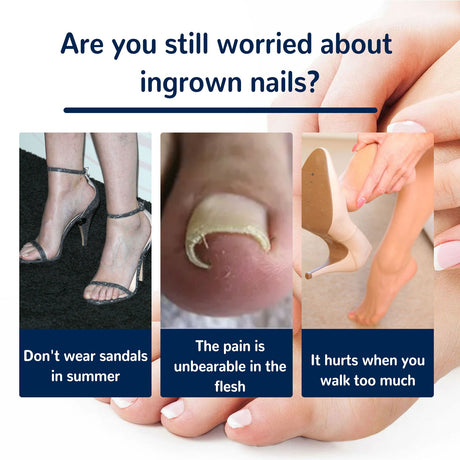 EELHOE toe nail correction patch - V.I.P Digital Presence