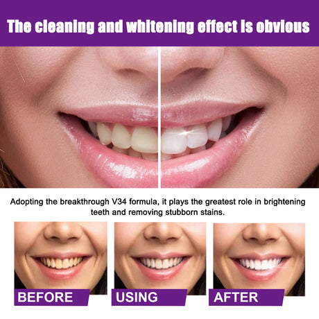 Color Correcting Technology, Clean Stains And Oral Odor Care For Gums Whitening Tooth Toothpaste - V.I.P Digital Presence
