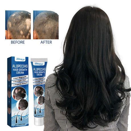 Alopecias Hair Growth Cream, Protect Hair Follicles Strong Moisturizing Thick Hairline Hair - V.I.P Digital Presence