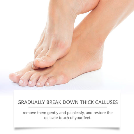 Foot Callous Removal Repair Cream Gently Softers Exfoliation Soothing Dry Moisturizing Hydrating Repair Cream - V.I.P Digital Presence