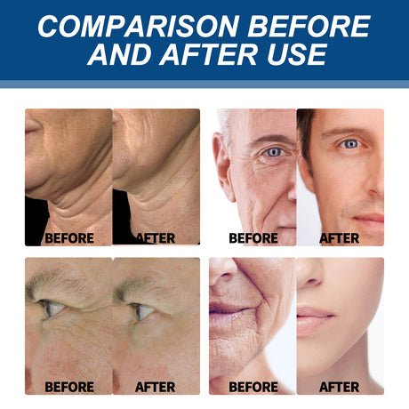 Collagen Wrinkle Remover Cream for Men, Anti Aging Fade Fine Lines Tightening Hydrating Cream - V.I.P Digital Presence