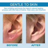 Piercing Repair Drops For Ear Piercing Care Gently Relieves Piercing Lumps And Moisturizes Skin