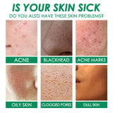 Facial Green Tea Vitamin Cleanse Mask, Facial Acne Deep Moisturizing Smear Delicate Pores Tender Skin - V.I.P Digital Presence