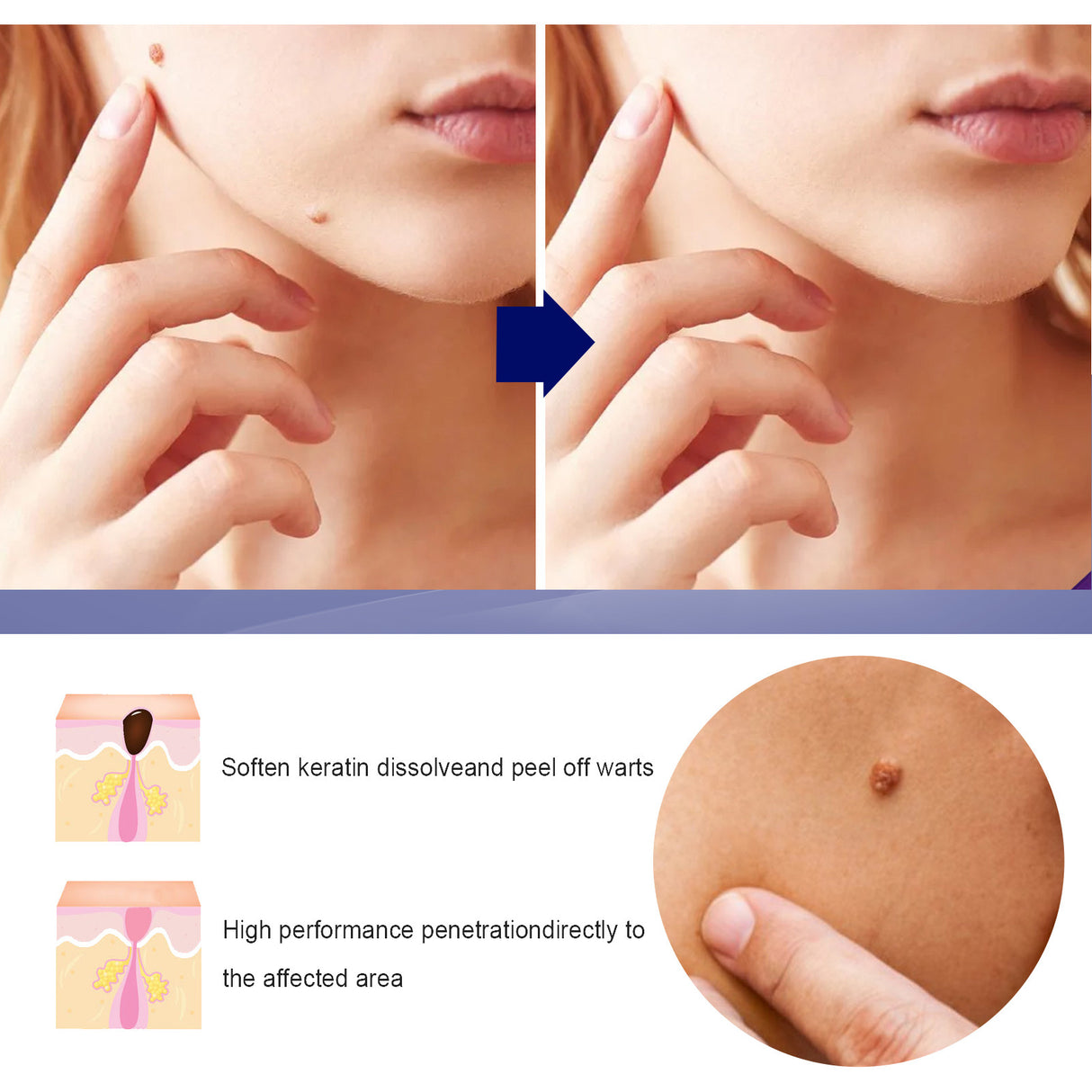Skin Care Cream Moisturizing Body Skin Label Gentle Moisturizing Clean Smooth Kayo Care Cream - V.I.P Digital Presence