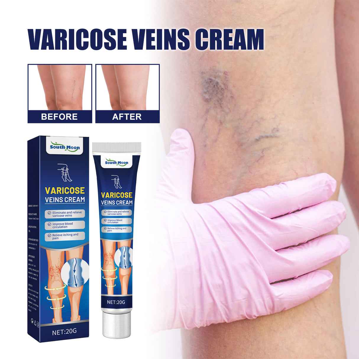 Vein Massage Varicose Cream Repair Earthworm Legs To Relieve Leg Blood Vessel Bulge And Varicoidea - V.I.P Digital Presence