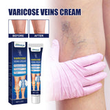 Vein Massage Varicose Cream Repair Earthworm Legs To Relieve Leg Blood Vessel Bulge And Varicoidea - V.I.P Digital Presence