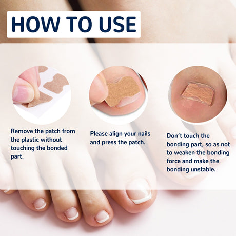 EELHOE toe nail correction patch - V.I.P Digital Presence