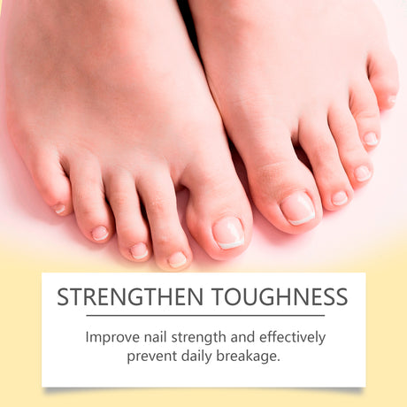 Bee Venom Nail Care Essence Foot Gray Nails Brightening Nails Rotten Nails Soft Nails Nail Care - V.I.P Digital Presence