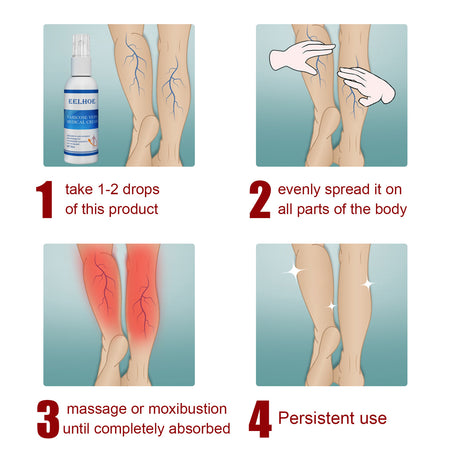 Intravenous Massage Spray For Varicose Veins Relief And Earthworm Leg Blood Vessel Bulge Pain Spray - V.I.P Digital Presence