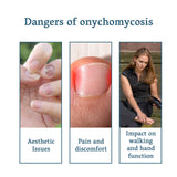 Nail Fungus Treatment, Nail Thickening Of Embedded Light Mail This Soft Armour Brothers Nails Detailer - V.I.P Digital Presence