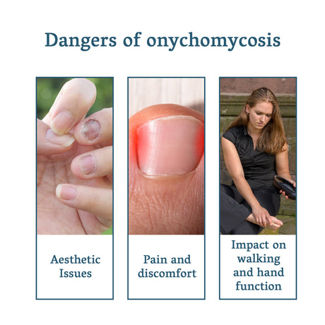 Nail Fungus Treatment, Nail Thickening Of Embedded Light Mail This Soft Armour Brothers Nails Detailer - V.I.P Digital Presence