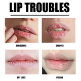 Lip Scrub, Lip Wrinkles Dry Dead Skin Moisturizing Toot Lips Moist Lips Lip Care - V.I.P Digital Presence