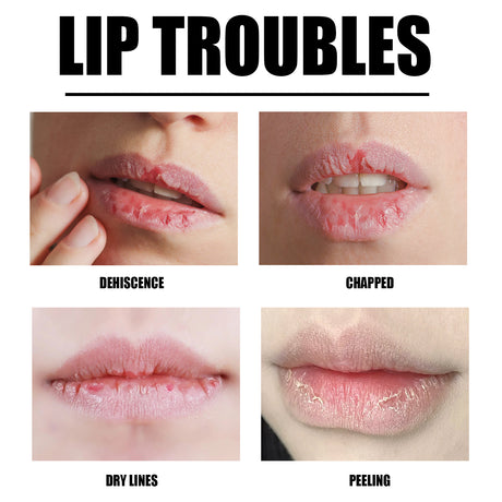 Lip Scrub, Lip Wrinkles Dry Dead Skin Moisturizing Toot Lips Moist Lips Lip Care - V.I.P Digital Presence