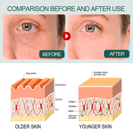 OUHOE Essence collagen replenishing essence whitening freckle removal facial essence brightening hydrating moisturizing - V.I.P Digital Presence