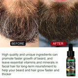 Beard Oil, Nourishing Moisturizing Spray Facial Hair Treatment Promotes Facial Growth And Thickening Liquid - V.I.P Digital Presence