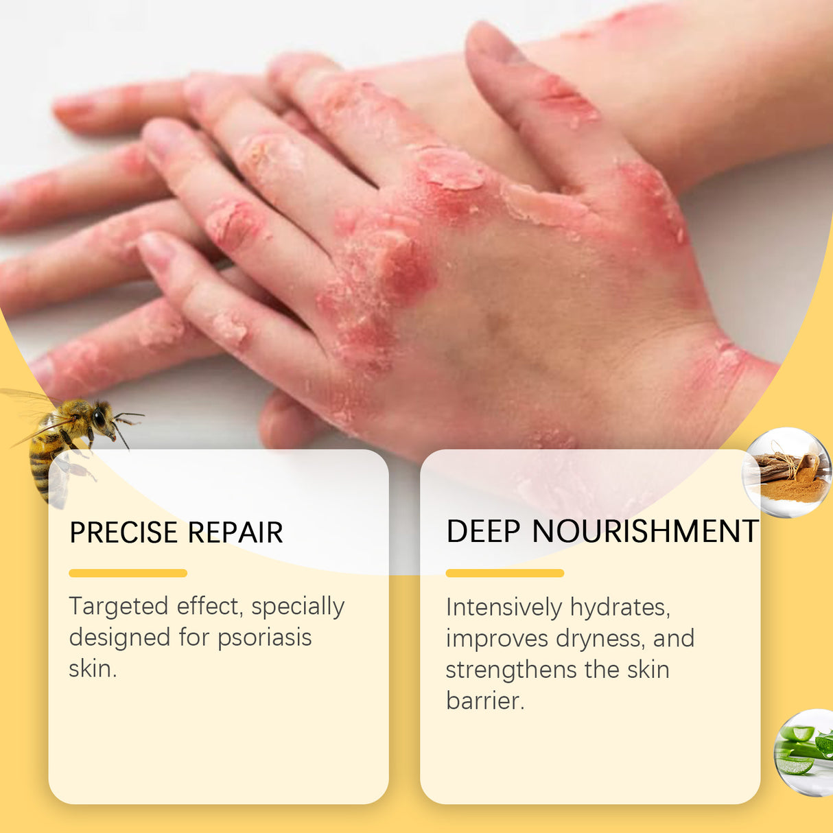 Skin Care Cream Moisturizing Herbal Cool Soothing Moisturizing Anti-Dandruff Moisturizing Gentle Skin Care