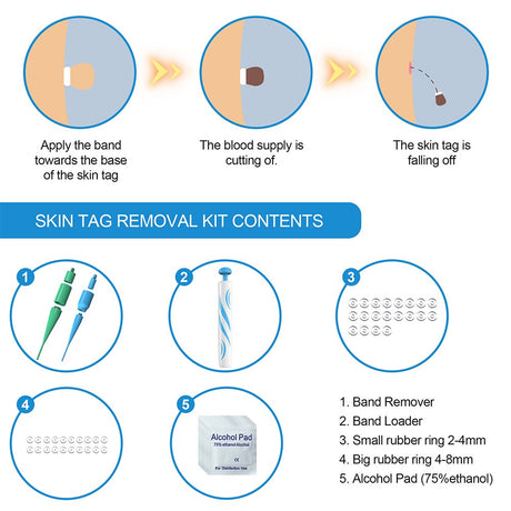 Auto Skin Tag Remover Kit Safe Painless Wart Acne Nodule Mole Corns Removal Pen Facial Cleaning Care Products Dropshipping - V.I.P Digital Presence