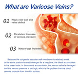 Leg Care Cream Relieves Leg Discomfort Pamper And Moisturize Skin Daily Massage Treatment - V.I.P Digital Presence