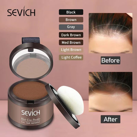 Forehead Sparse Hair Concealment and Contouring Hairline Filler - V.I.P Digital Presence