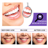 Teeth Whitening Toothpaste, Removing Teeth Stains And Odors Oral Care Brightening And Whitening Teeth Toothpaste - V.I.P Digital Presence
