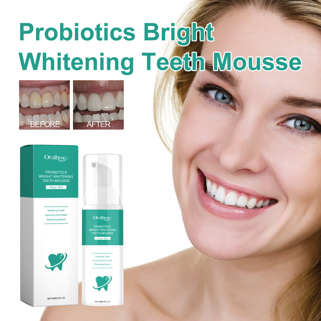 Probiotics Bright Whitening Teeth Mousse, Clean Mouth Odor Tartar Very Well To Protect The Gum Beautiful White Teeth - V.I.P Digital Presence