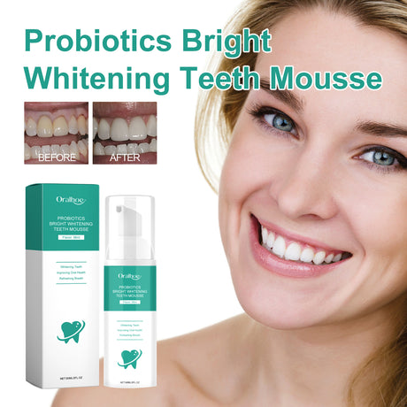Probiotics Bright Whitening Teeth Mousse, Clean Mouth Odor Tartar Very Well To Protect The Gum Beautiful White Teeth - V.I.P Digital Presence
