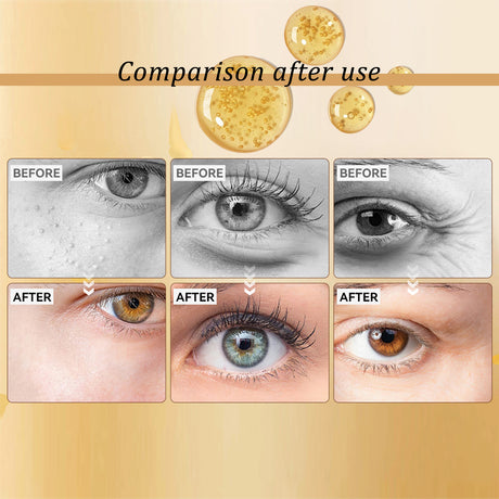 Premium Snail Peptide Eye Cream, Elastic Muscle To Reduce Puffiness And Fine Lines Around The Eye Skin Roller Massage Care Eye Cream - V.I.P Digital Presence