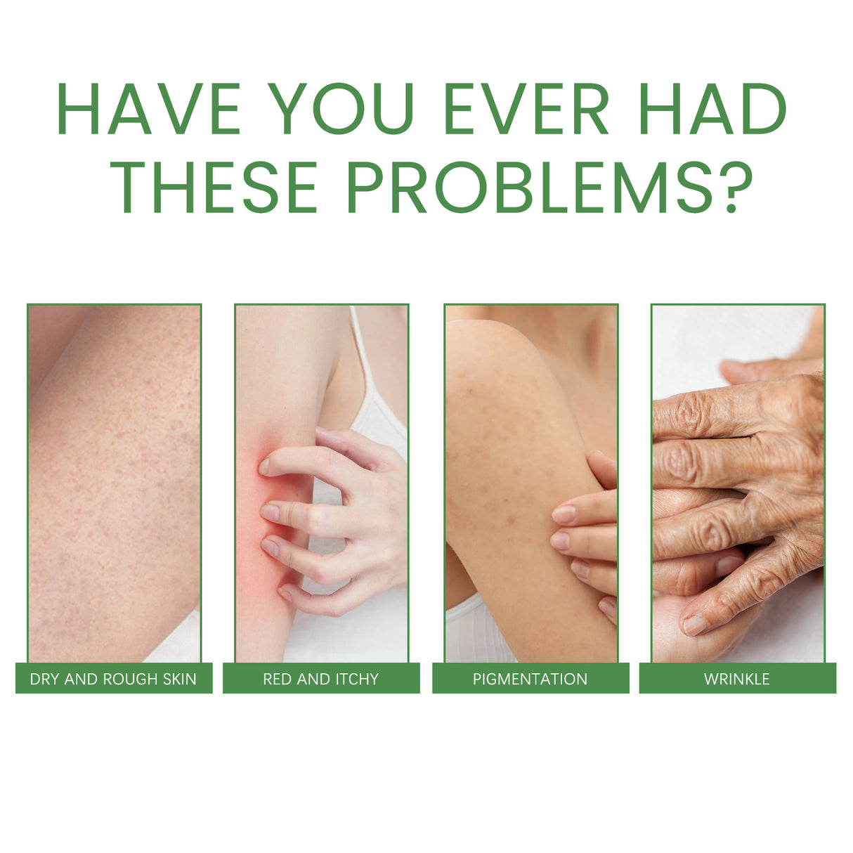 Firming Collagen Body Cream Moisturizes And Repairs Chicken Skin, Prevents Dry, Tender And Smooth Skin, Brightening And Beautifying Skin