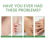 Firming Collagen Body Cream Moisturizes And Repairs Chicken Skin, Prevents Dry, Tender And Smooth Skin, Brightening And Beautifying Skin