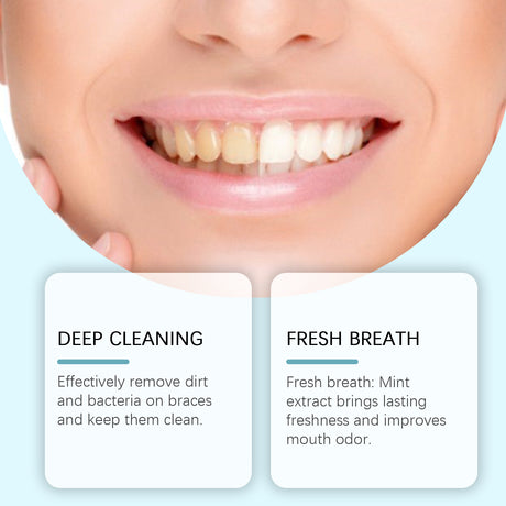 Braces Cleansing Mousse, Teeth And Mouth Fresher Corrector Gentle Cleansing Foam - V.I.P Digital Presence