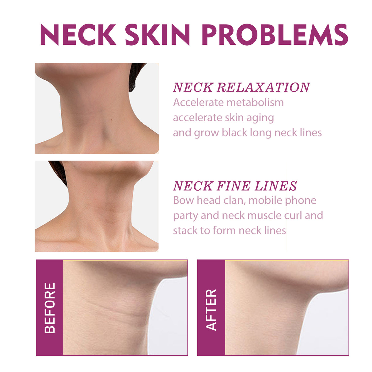 Hydrolyzed Collagen Neck Cream, Fade Neck Lines Shaping Swan Neck Smooth White Neck Cream
