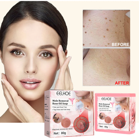 Verruca Rose Essential Oil Soap Body Cleaning Nevus Verruca Face And Neck Silk Verruca Essence Soap - V.I.P Digital Presence