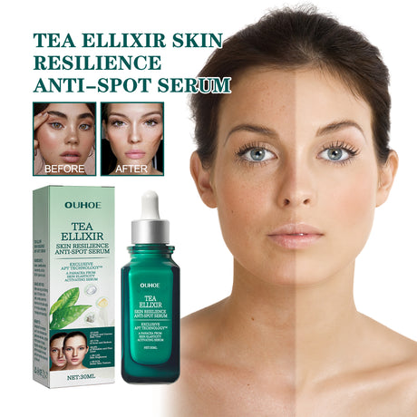Brightening Blemish Essence, Lightening Melasma Blemish Hydrating And Brightening Skin Essence - V.I.P Digital Presence