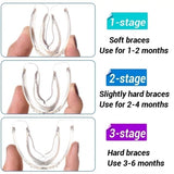 3 Stages Dental Orthodontic Braces Appliance Braces Alignment Trainer Teeth Retainer Bruxism Mouth Guard Teeth Straightener - V.I.P Digital Presence