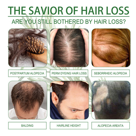 Rosemary Hair Dense Essential Oil, Prevent Hair Breakage And Hair Loss Strong, Strong And Solid Hair Moisturizing Root Dense Essential Oil - V.I.P Digital Presence