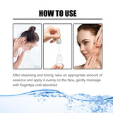 Nicotinic Acid Face Essence Lighten Acne Marks, Moisturize Pores, Shrink And Whiten Skin Beauty Essence - V.I.P Digital Presence