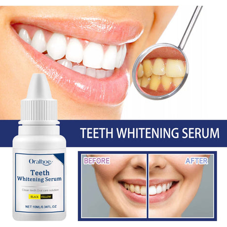 Teeth Whitening Serum, Remove Stains Yellow Dirt Deep Cleaning Whitening Essence - V.I.P Digital Presence