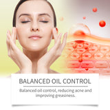 Beesvenom Acne-Clearing Cream Refreshing Shine Oil Control Balance Skin Gentle Moisturizing Skin Care Moisturizing Acne-Clearing Face Cream